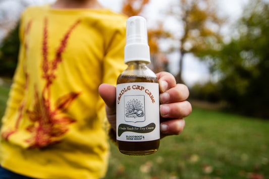 Cradle Cap Care | Herbal Oil